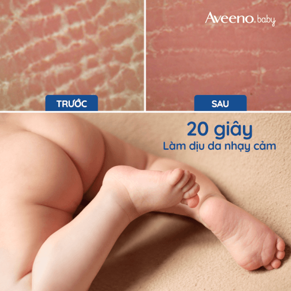 Combo 2 Kem dưỡng da cho bé Aveeno Baby dành cho da khô & nhạy cảm 227g