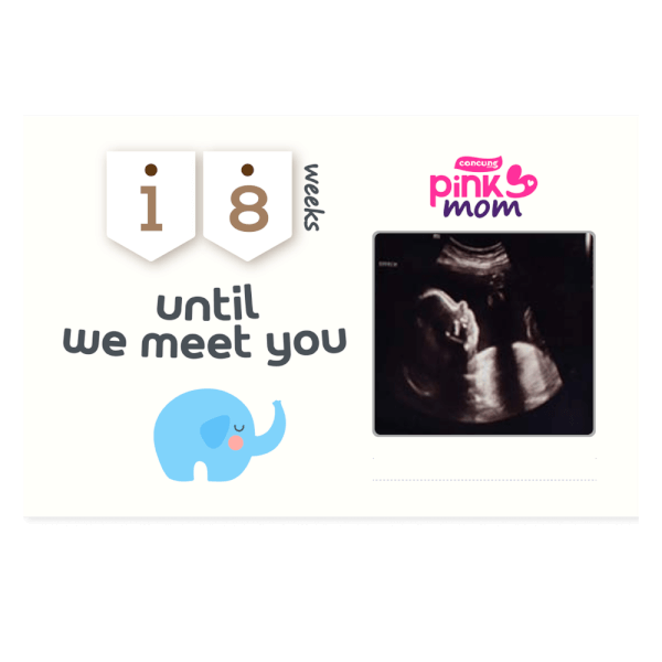 Tặng 1 khung ảnh Hello Baby 100K cho Hội Viên ≤ 16 tuần thai