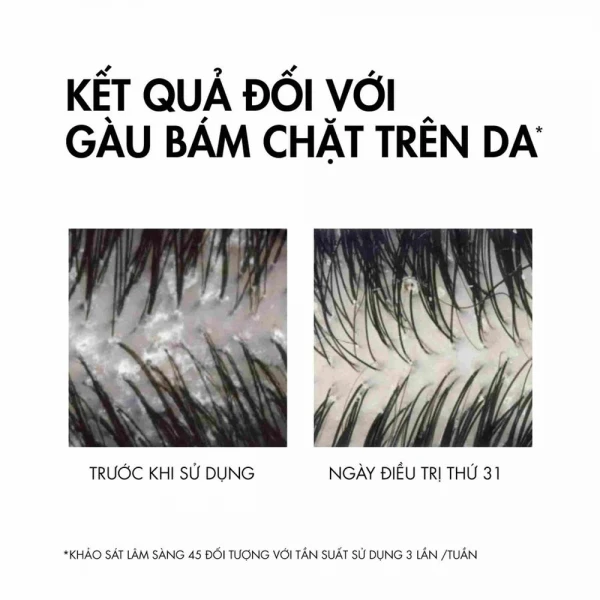 Dầu gội Vichy Dercos Anti-Dandruff DS hỗ trợ làm sạch gàu cho da đầu dầu (200ml)
