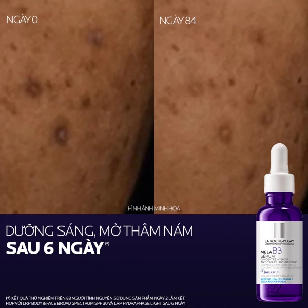 Serum La Roche-Posay Mela B3 hỗ trợ giảm thâm nám (30ml)