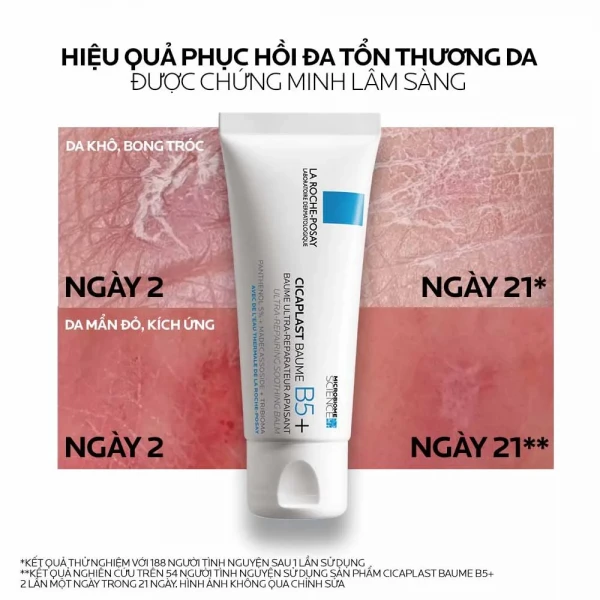 Kem dưỡng La Roche-Posay Cicaplast Baume B5+ cho bé từ 3 tháng (100ml)