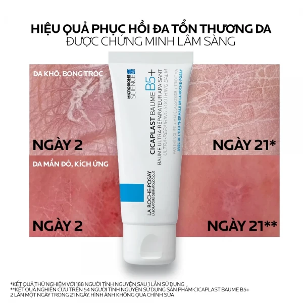 Kem dưỡng La Roche-Posay Cicaplast Baume B5+ cho bé từ 3 tháng (40ml)