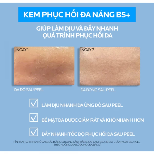 Kem dưỡng La Roche-Posay Cicaplast Baume B5+ cho bé từ 3 tháng (40ml)