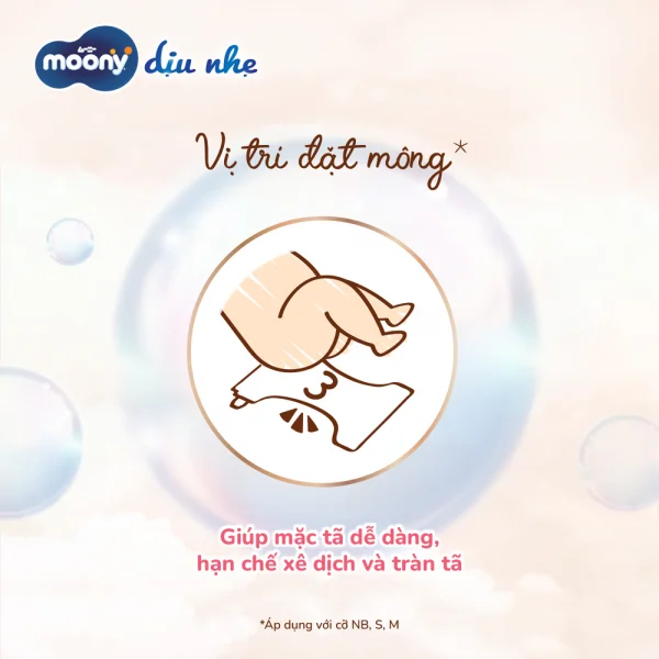 Bỉm tã dán Moony Dịu Nhẹ (NB, 60 miếng + 6 miếng) (bao bì giao ngẫu nhiên)