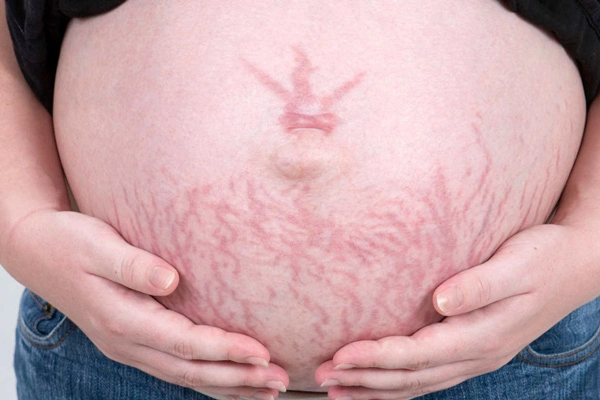 Mang thai tuần 30, cơ thể mẹ bầu thay đổi như thế nào? 