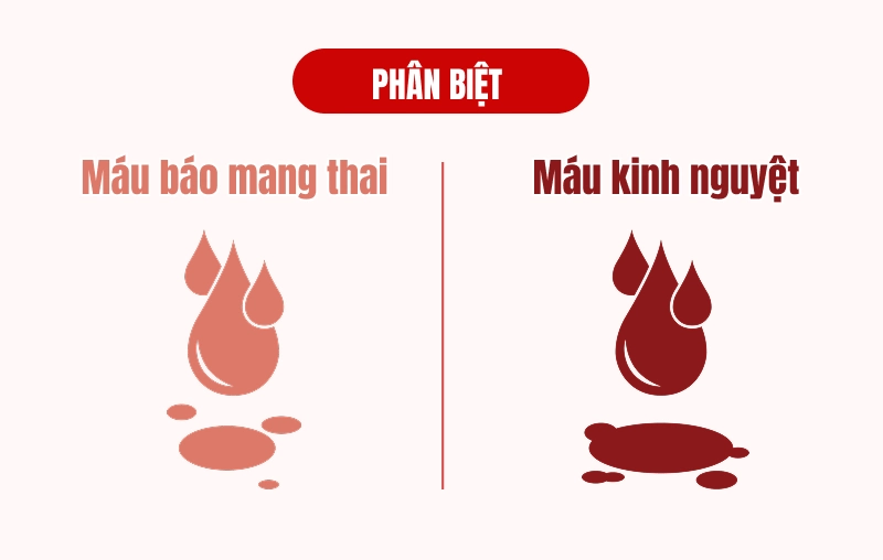 Dấu hiệu sắp đến tháng và có thai có điểm giống và khác như thế nào? Cách phân biệt cho mẹ