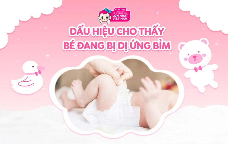Dấu hiệu cho thấy bé đang bị dị ứng bỉm và cách khắc phục dành cho mẹ