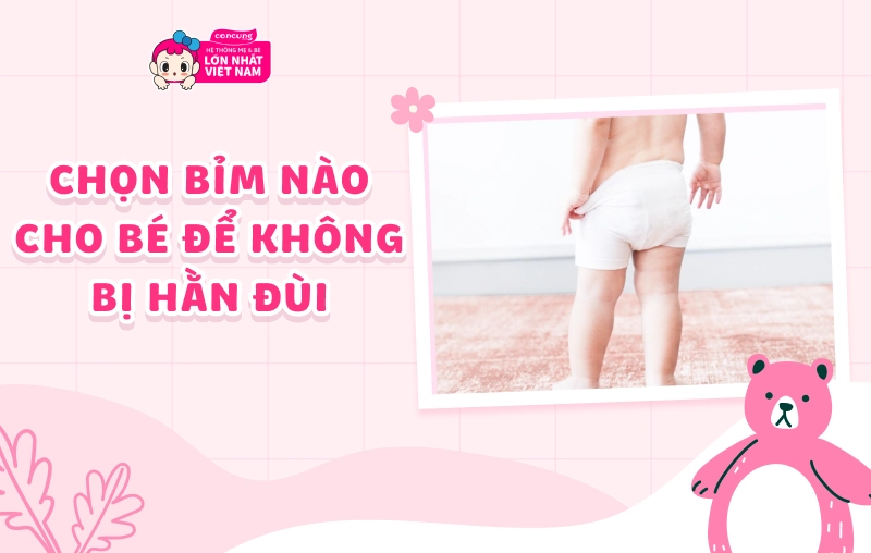 Chọn loại bỉm nào cho bé để không bị hằn đùi? Dấu hiệu và nguyên nhân mặc bỉm bị hằn da