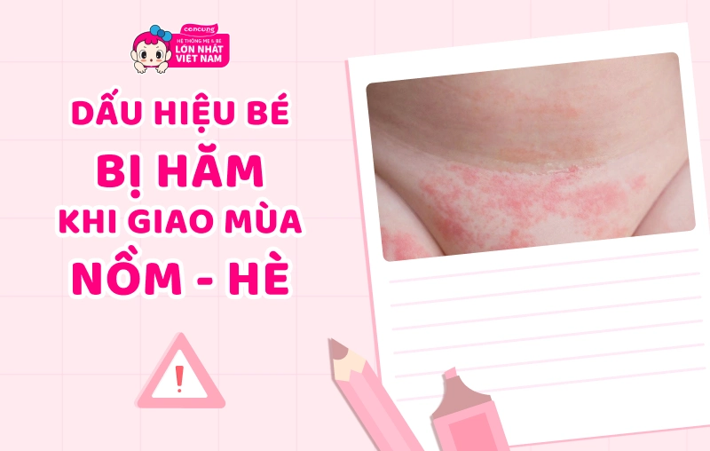 Dấu hiệu bé bị hăm bỉm khi giao mùa nồm - hè và cách chọn bỉm chuẩn cho mẹ