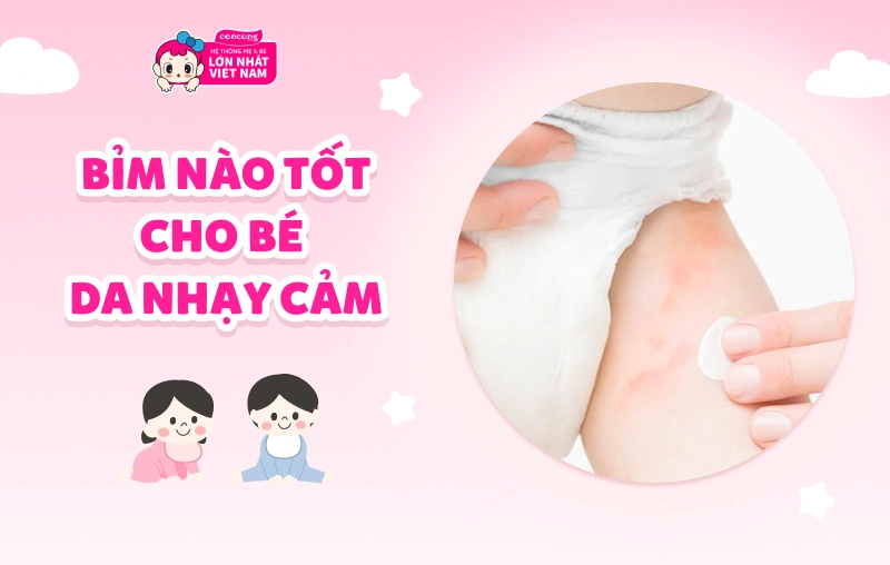 Bỉm nào tốt cho bé da nhạy cảm? Hướng dẫn chọn bỉm chuẩn cho bé tại Hà Nội