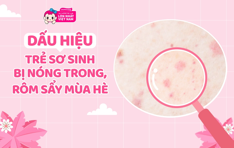 Review 5 dòng sữa mát “cứu tinh” cho trẻ sơ sinh có dấu hiệu bị rôm sảy, nóng trong