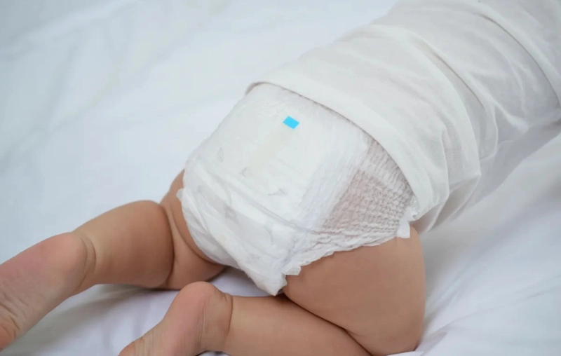 Review tã Mijuku là của nước nào? So sánh Mijuku và Takato tã nào tốt hơn?
