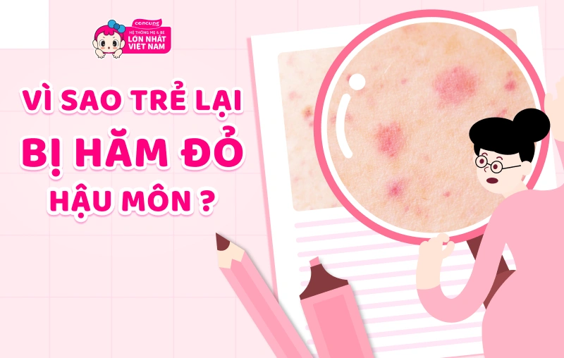 Trẻ bị hăm đỏ hậu môn