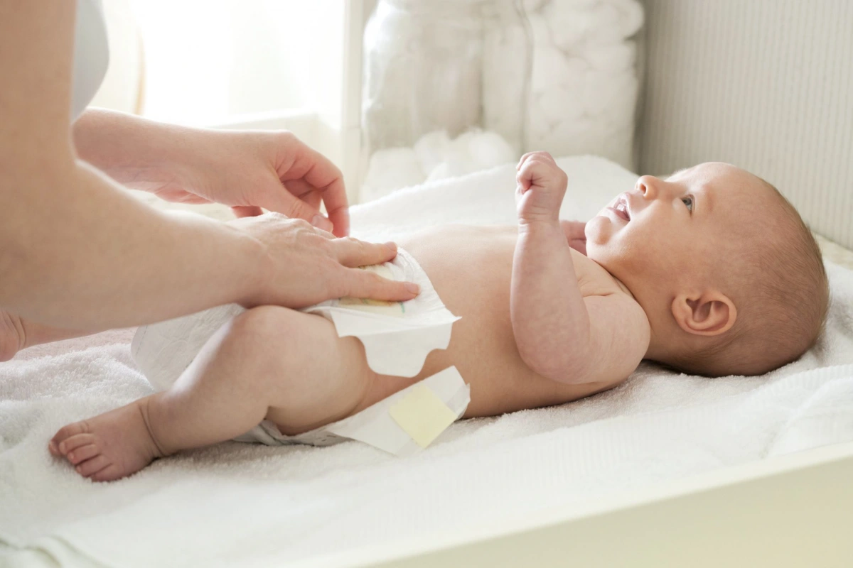 Mẹ c&oacute; thể mặc t&atilde; cho b&eacute; bị hăm, nhưng phải chọn loại t&atilde; bỉm ph&ugrave; hợp.