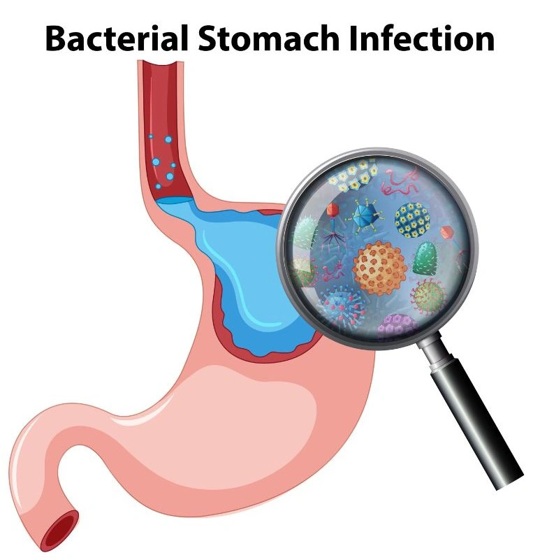 Trẻ bị nhiễm khuẩn đường ruột